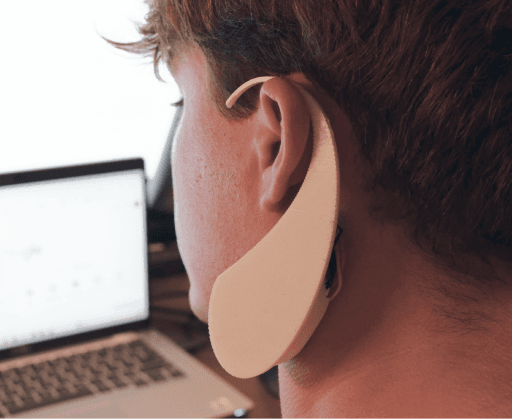 Parasomatic Device - Circuit Components